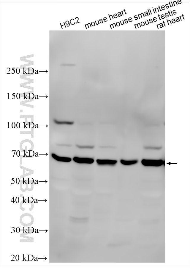 Various lysates were subjected to SDS PAGE followed by western blot with 12316-1-AP (ANGPTL2 antibody) at dilution of 1:2000 incubated at room temperature for 1.5 hours. WB analysis using 12316-1-AP
