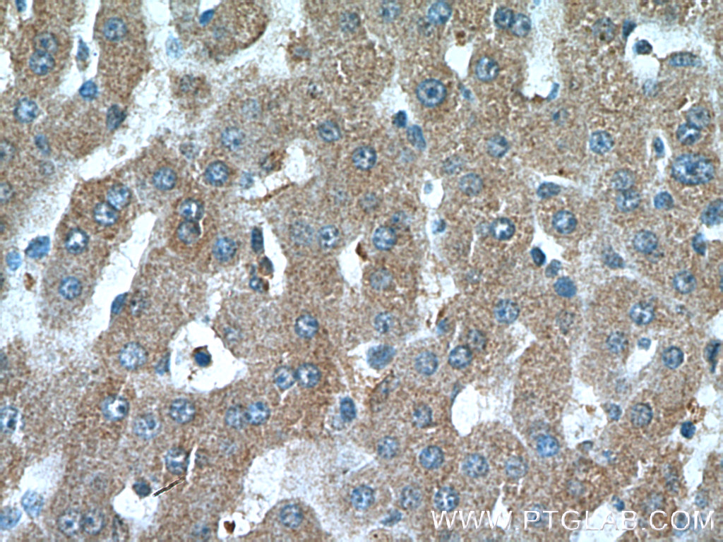 IHC staining of human liver using 11964-1-AP