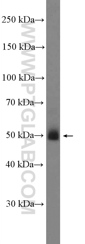 WB analysis of A375 using 11964-1-AP