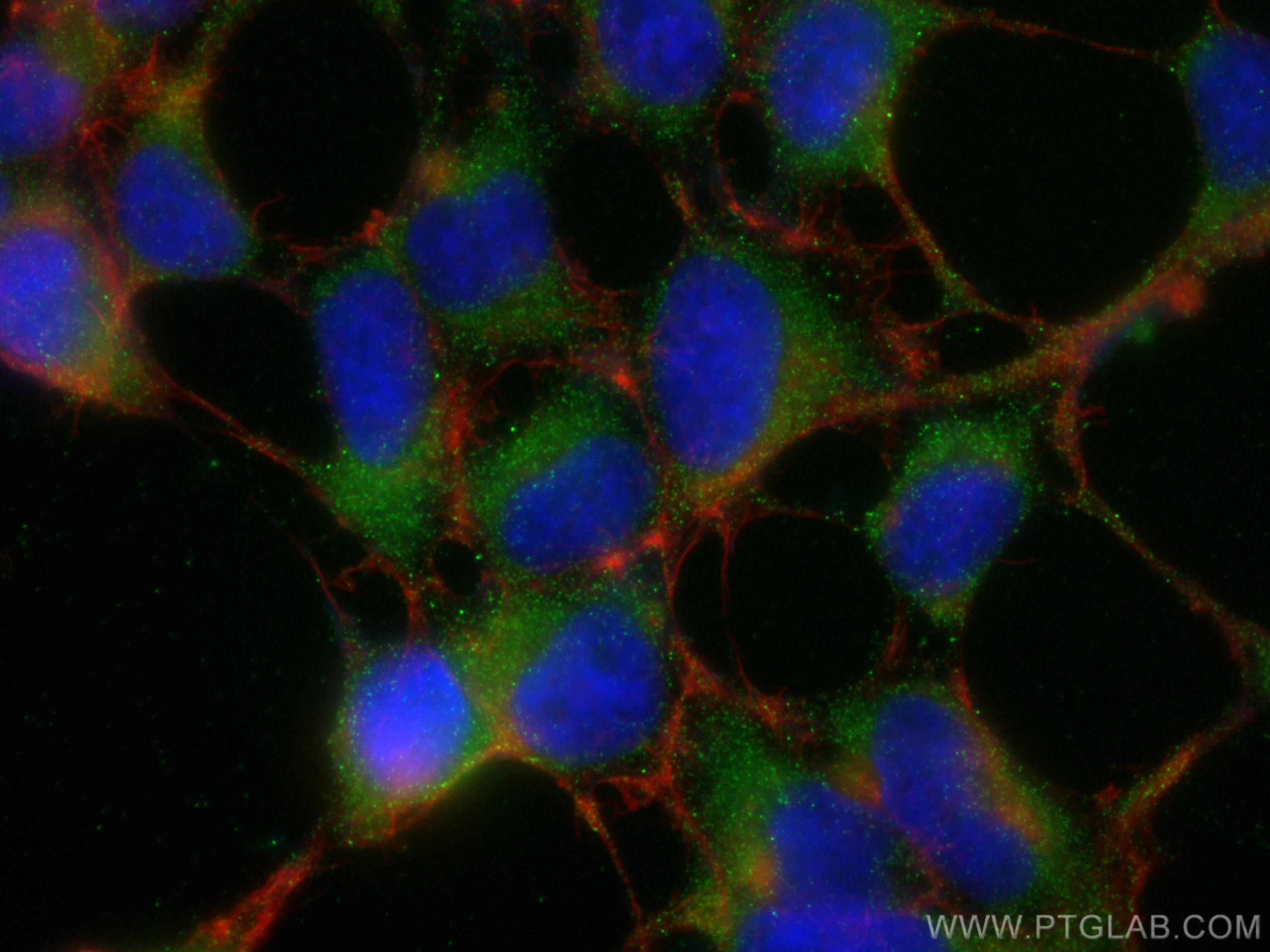 IF Staining of HEK-293 using 18374-1-AP