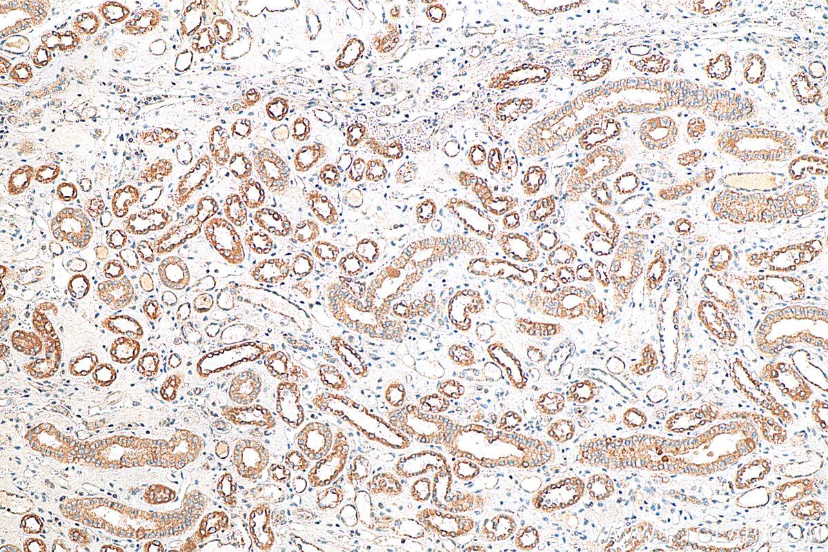 IHC staining of human kidney using 18374-1-AP