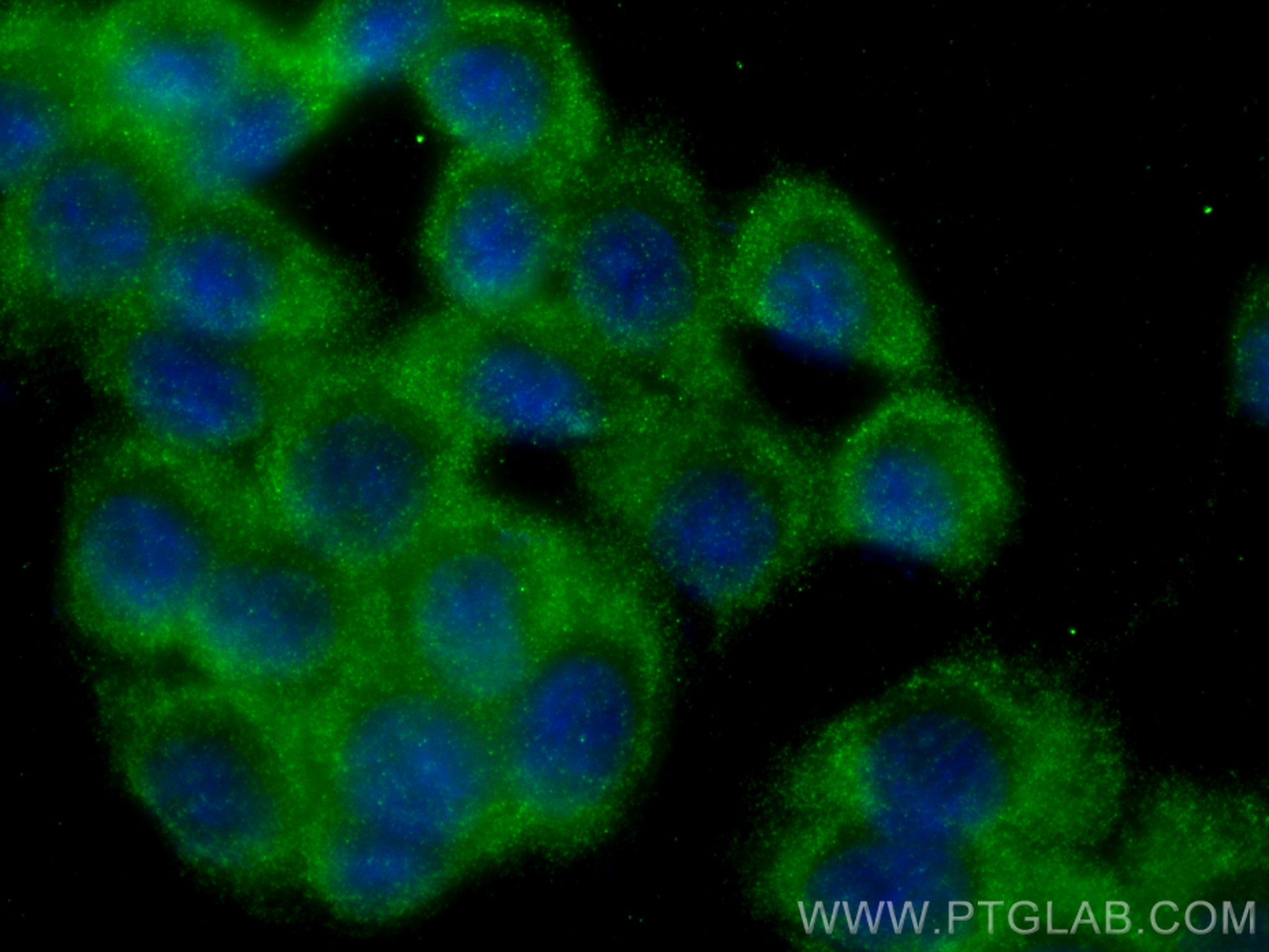 IF Staining of HT-29 using 31497-1-AP IF Staining of HT-29 using 31497-1-AP