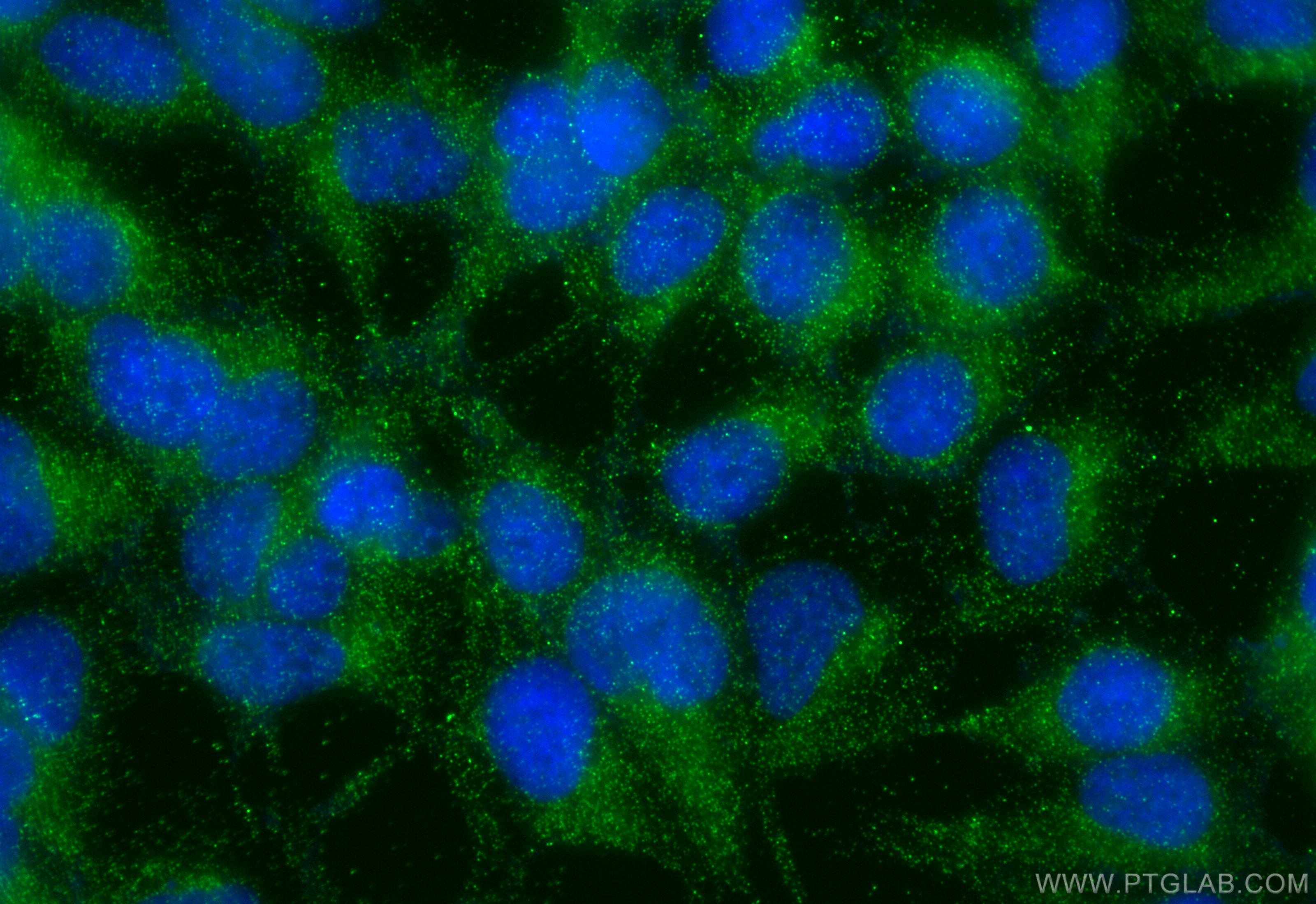 IF Staining of HEK-293 using 31497-1-AP IF Staining of HEK-293 using 31497-1-AP