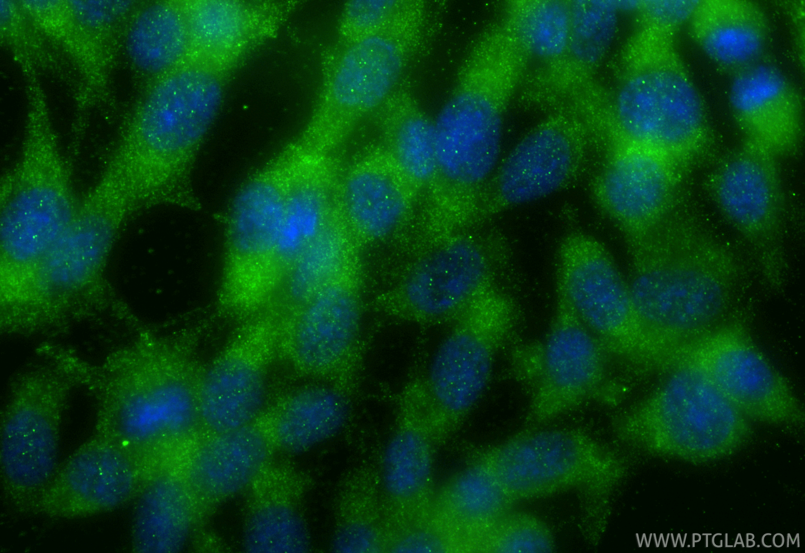 IF Staining of NIH/3T3 using 31497-1-AP IF Staining of NIH/3T3 using 31497-1-AP