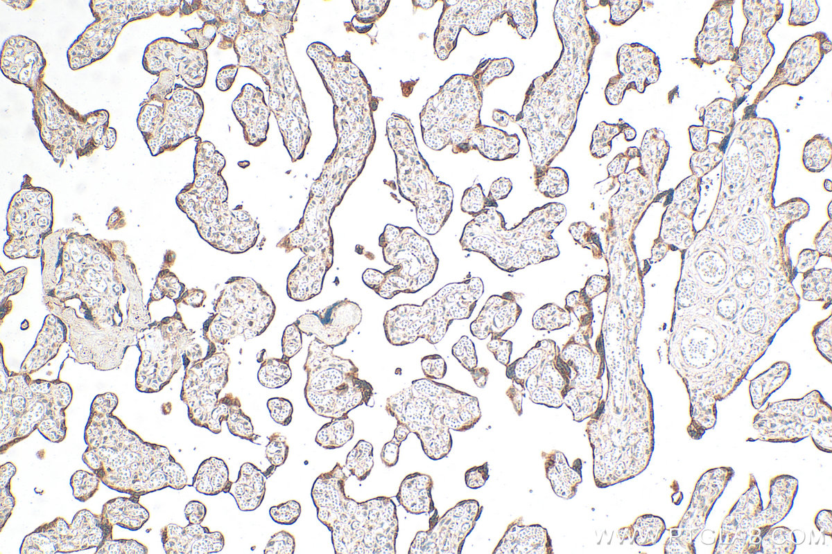 IHC staining of human placenta using 31497-1-AP IHC staining of human placenta using 31497-1-AP