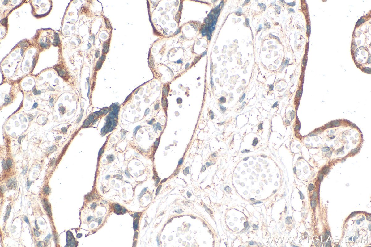 IHC staining of human placenta using 31497-1-AP IHC staining of human placenta using 31497-1-AP