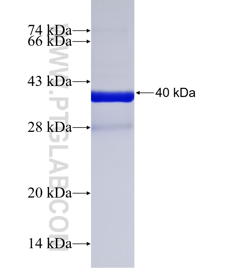 ANGPTL7 fusion protein Ag32199 SDS-PAGE ANGPTL7 fusion protein Ag32199 SDS-PAGE