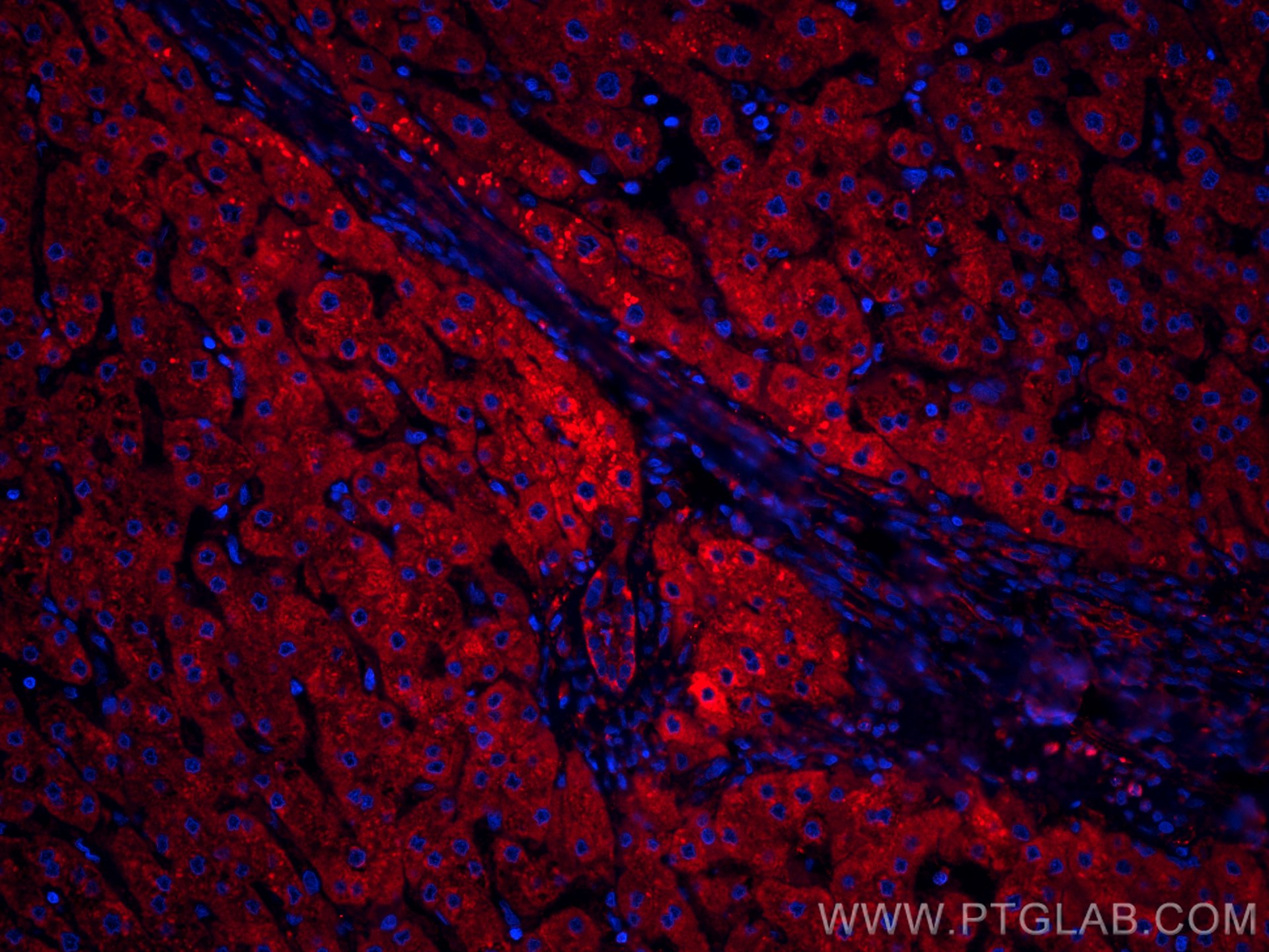 IF Staining of human liver using CL594-66641