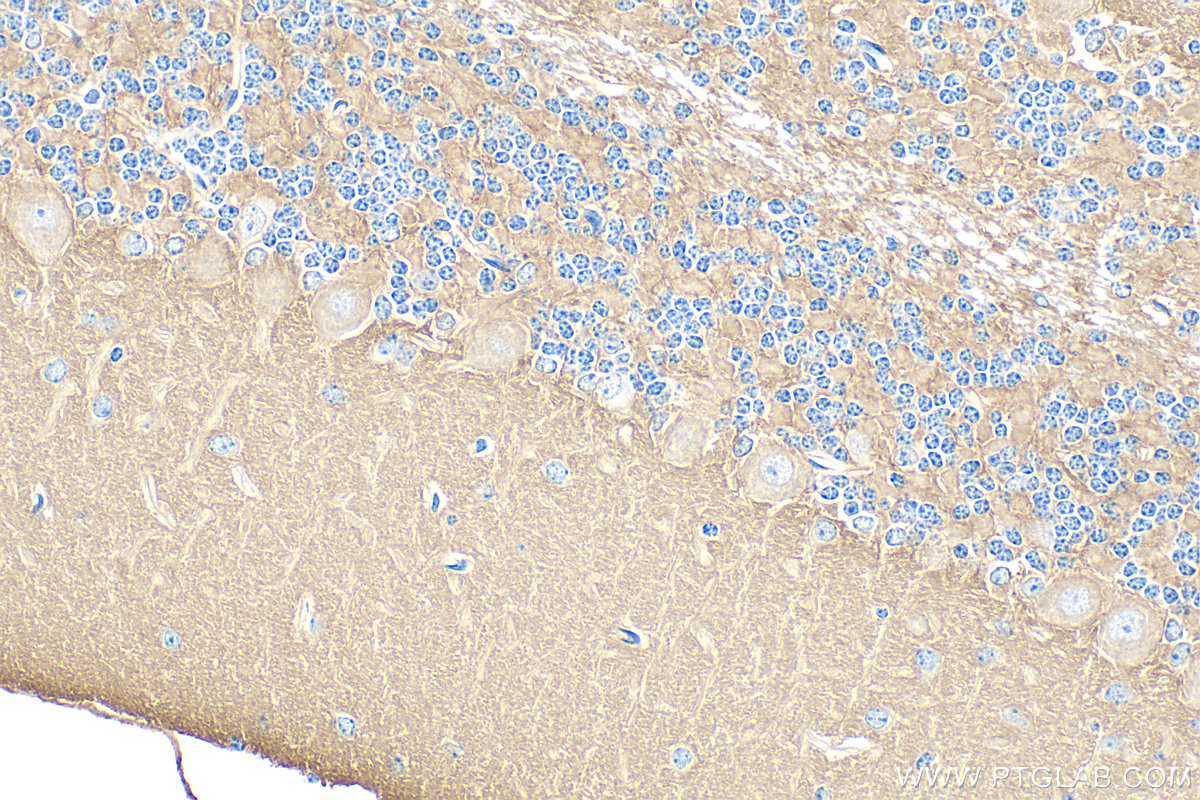 IHC staining of mouse cerebellum using 31080-1-AP