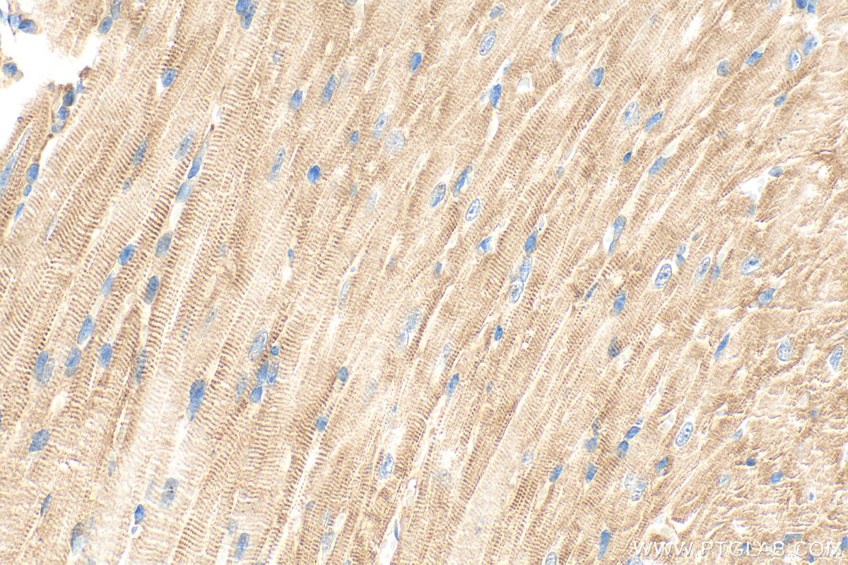 IHC staining of mouse heart using 31080-1-AP