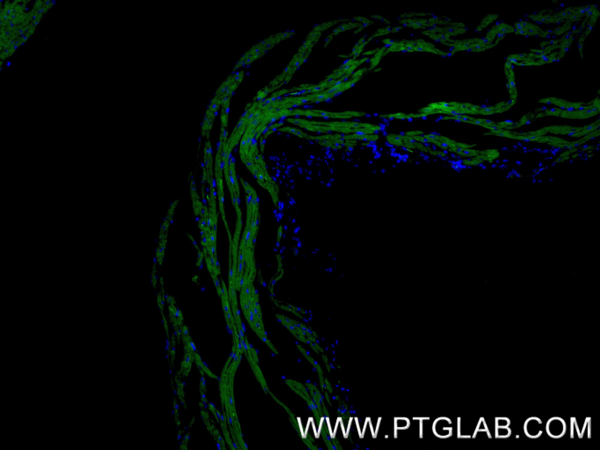 IF Staining of mouse heart using 83912-5-RR