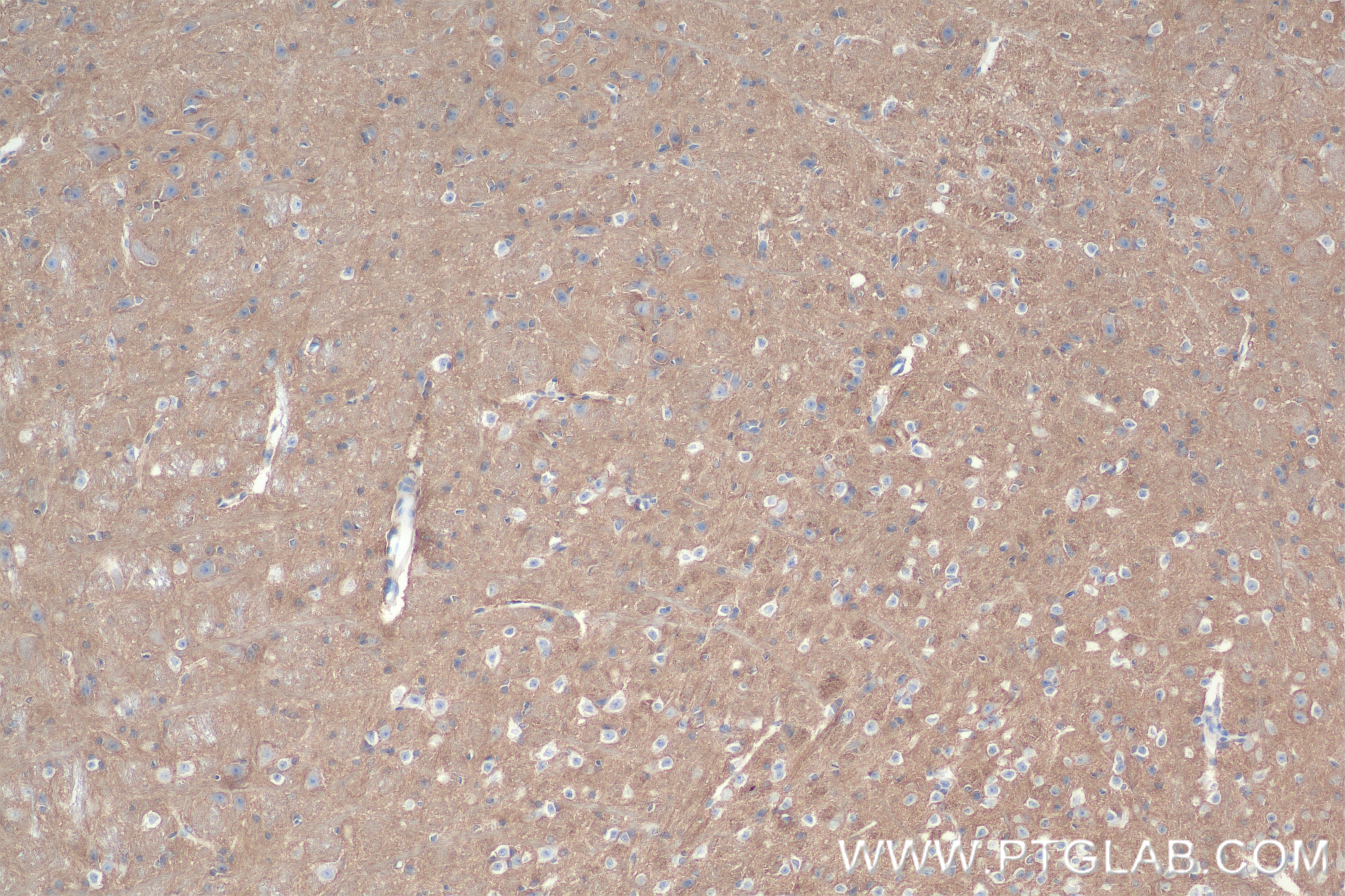 IHC staining of mouse cerebellum using 83912-5-RR