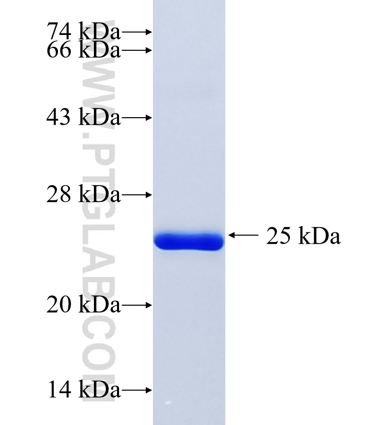 ANK2 fusion protein Ag34683 SDS-PAGE ANK2 fusion protein Ag34683 SDS-PAGE