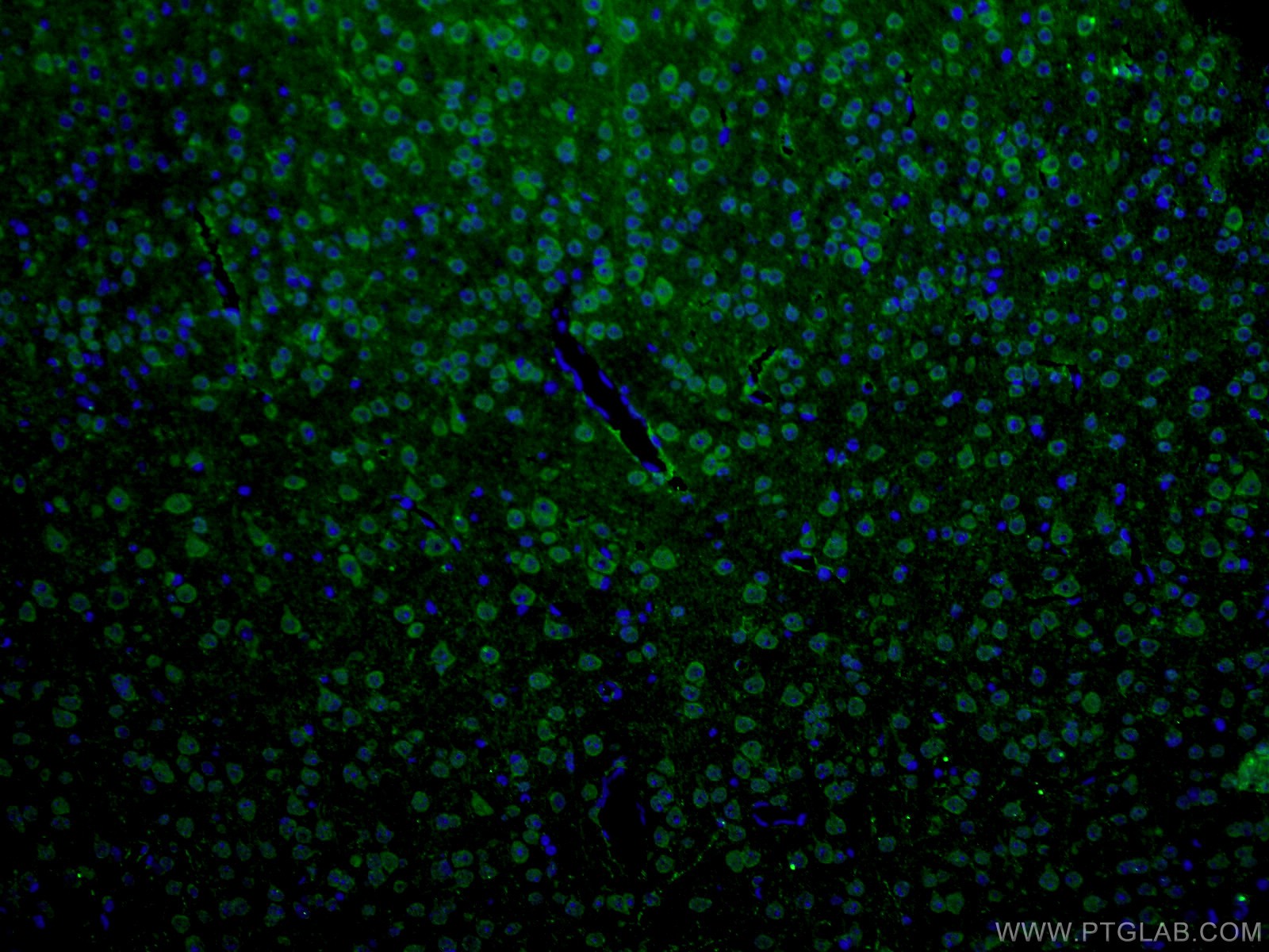 IF Staining of mouse brain using 27766-1-AP