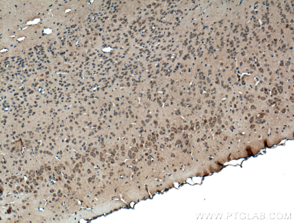 IHC staining of mouse brain using 27766-1-AP