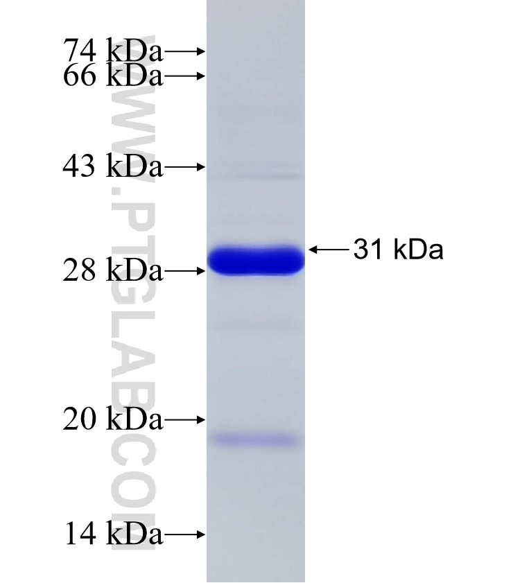 ANKFN1 fusion protein Ag32938 SDS-PAGE ANKFN1 fusion protein Ag32938 SDS-PAGE