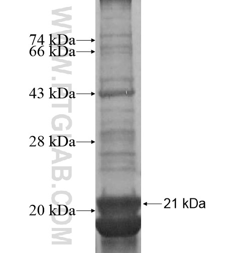 ANKH fusion protein Ag14568 SDS-PAGE ANKH fusion protein Ag14568 SDS-PAGE