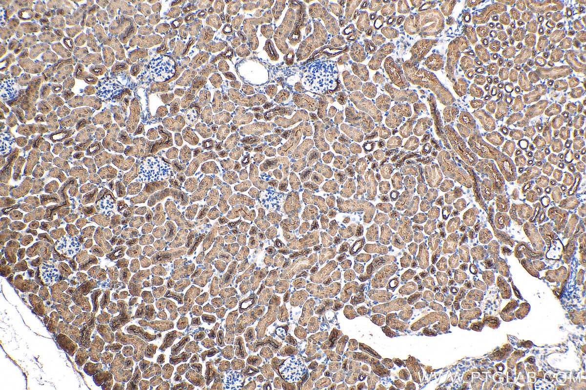 IHC staining of mouse kidney using 30467-1-AP