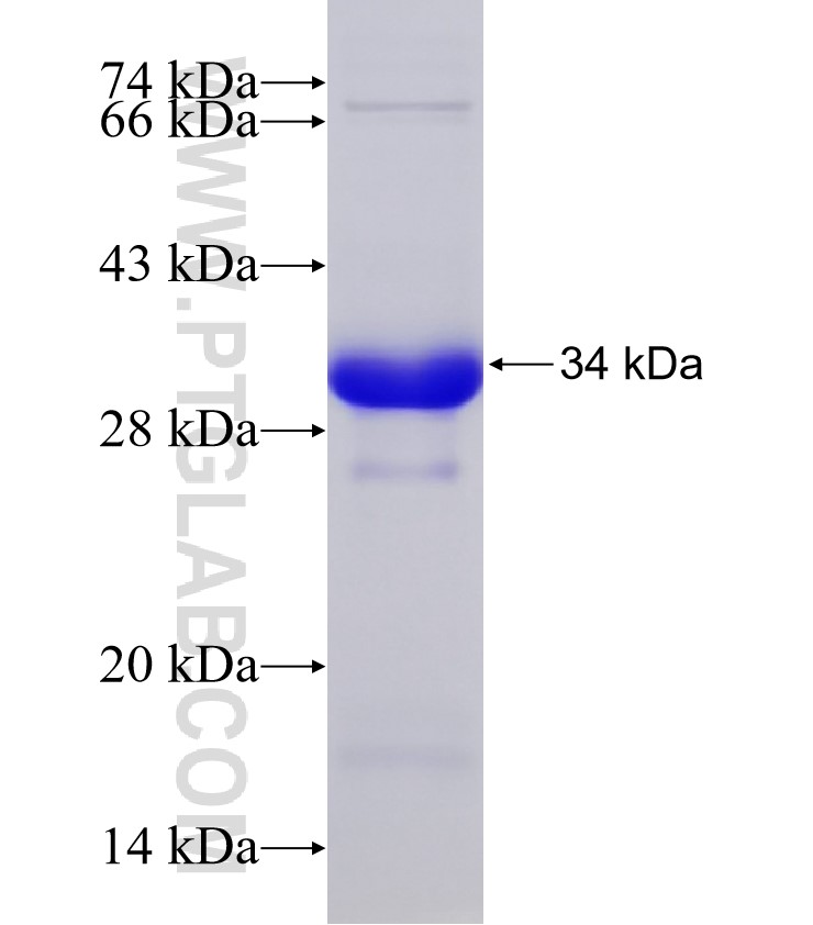 ANKIB1 fusion protein Ag32935 SDS-PAGE ANKIB1 fusion protein Ag32935 SDS-PAGE