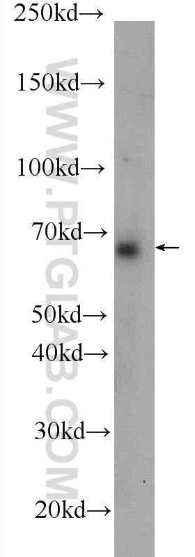 WB analysis of HeLa using 24080-1-AP