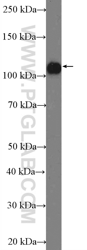 WB analysis of HeLa using 26293-1-AP