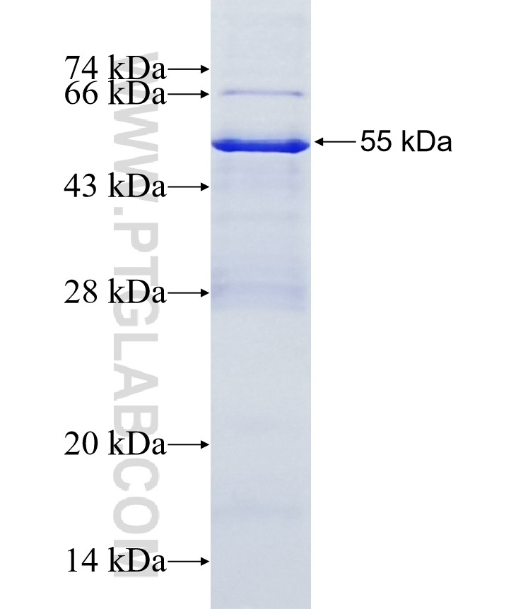 ANKMY1 fusion protein Ag15020 SDS-PAGE ANKMY1 fusion protein Ag15020 SDS-PAGE