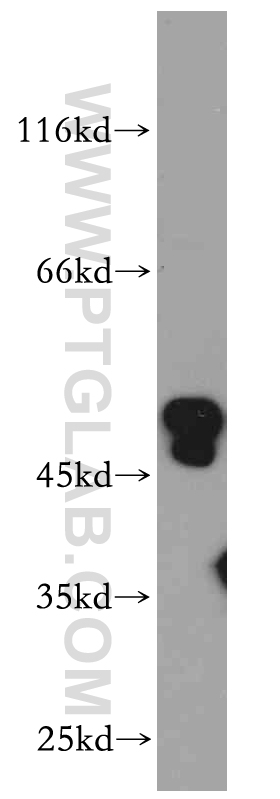 WB analysis of HeLa using 21065-1-AP