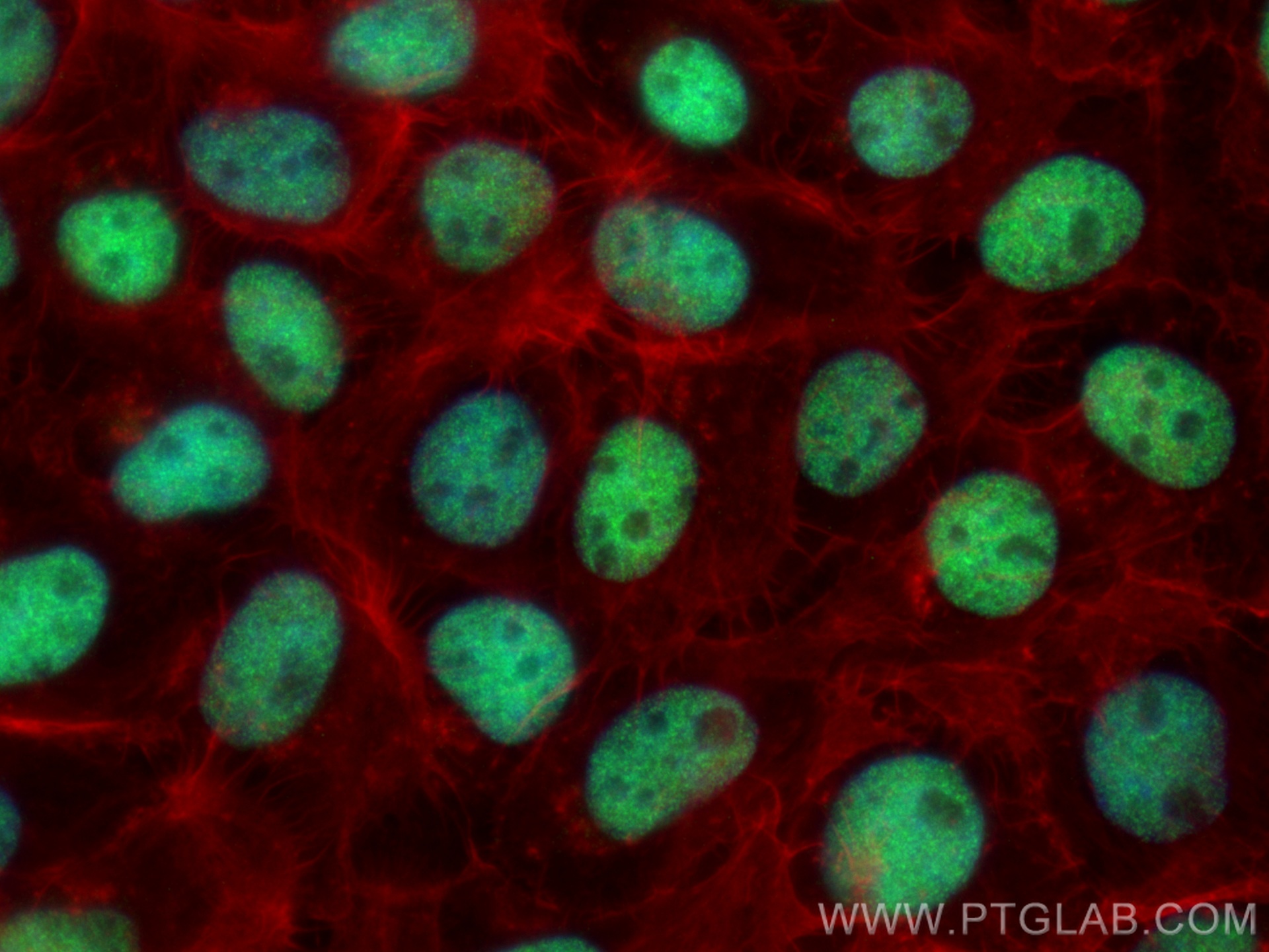 IF Staining of A431 using 67775-1-Ig (same clone as 67775-1-PBS)