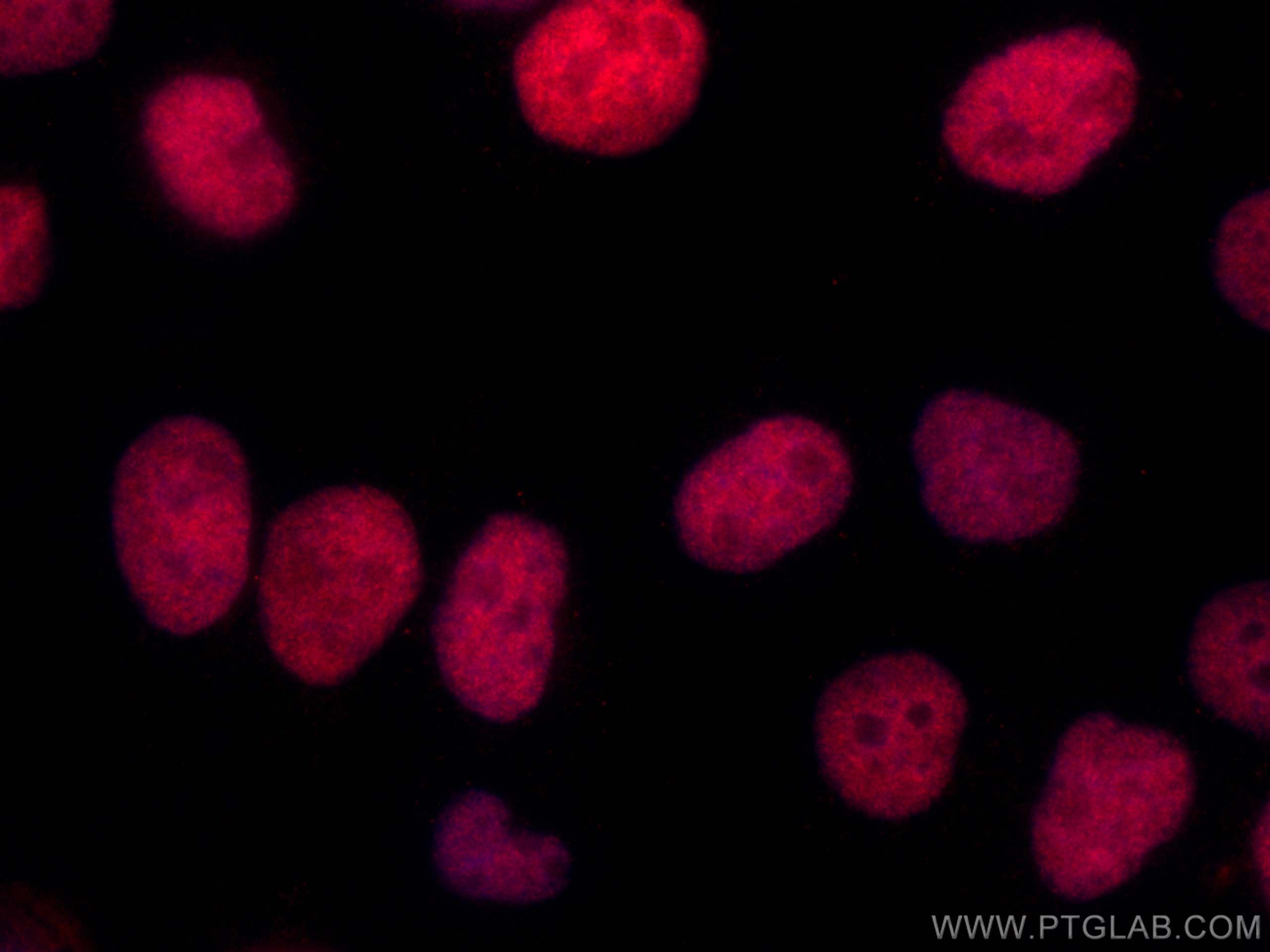 IF Staining of A431 using CL594-67775