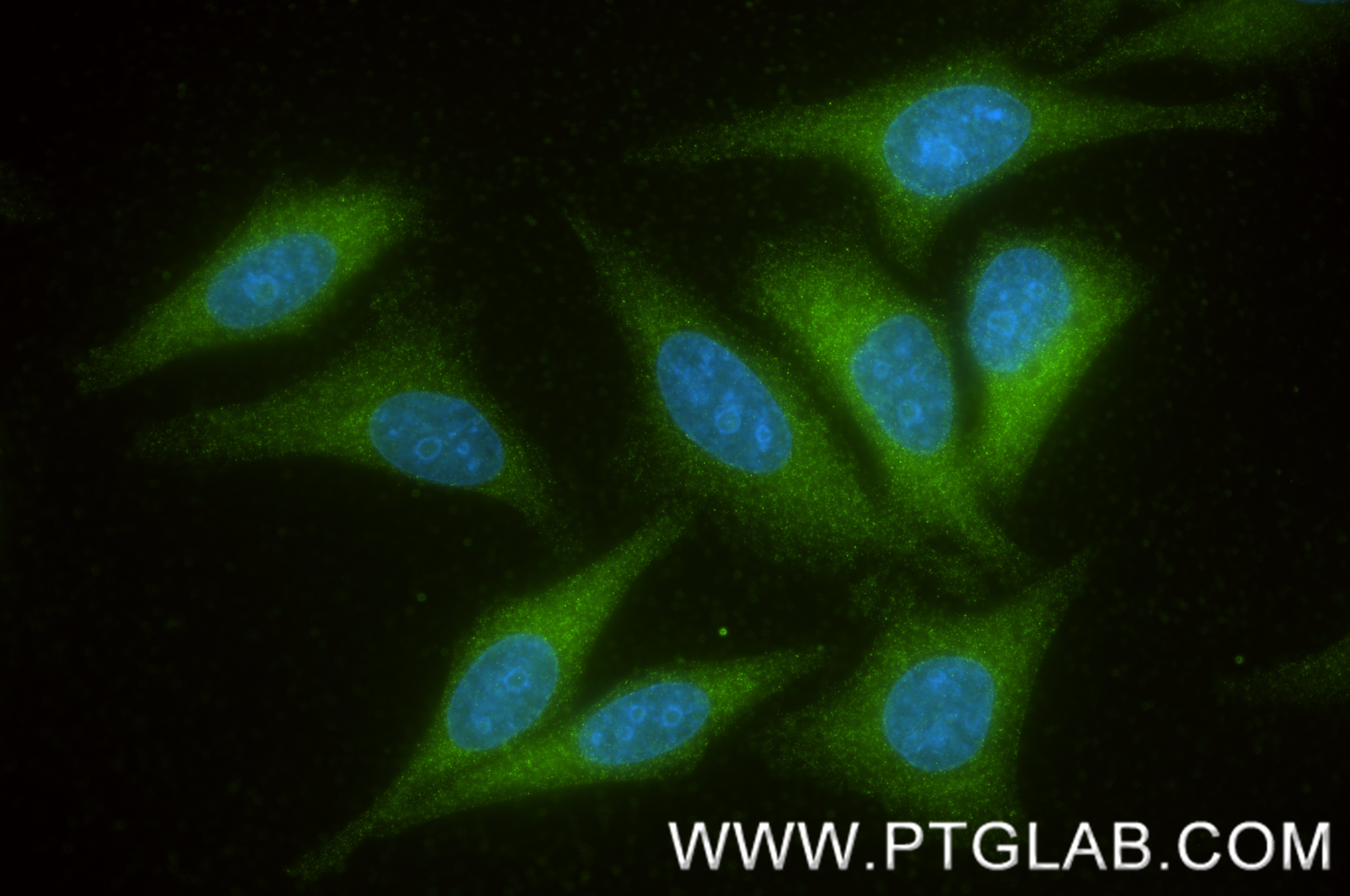 IF Staining of HepG2 using 87239-1-RR (same clone as 87239-1-PBS) IF Staining of HepG2 using 87239-1-RR (same clone as 87239-1-PBS)