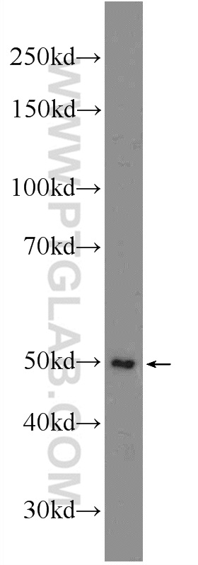 WB analysis of Jurkat using 21100-1-AP