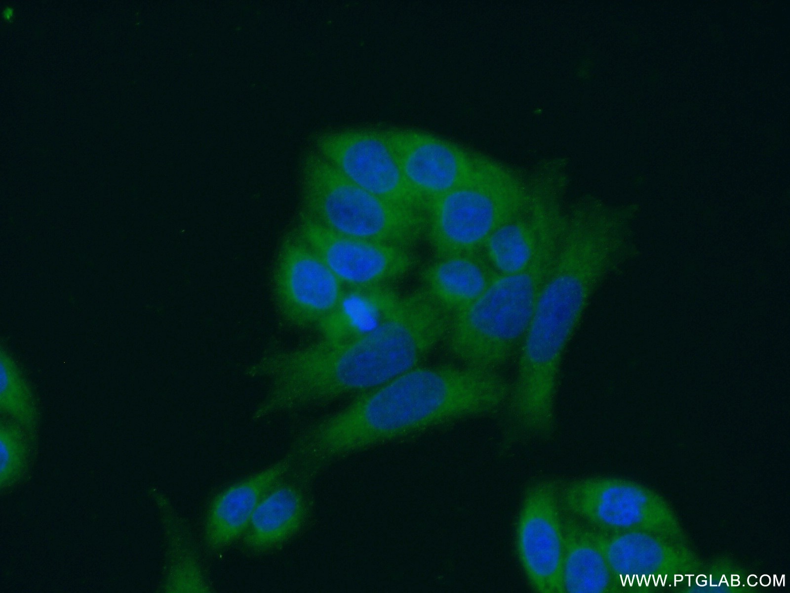 IF Staining of HeLa using 24334-1-AP