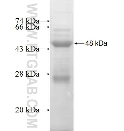ANKRD16 fusion protein Ag7186 SDS-PAGE ANKRD16 fusion protein Ag7186 SDS-PAGE