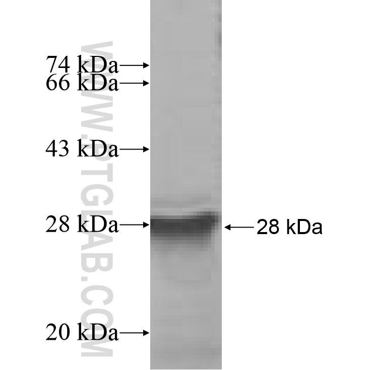 ANKRD16 fusion protein Ag7343 SDS-PAGE ANKRD16 fusion protein Ag7343 SDS-PAGE