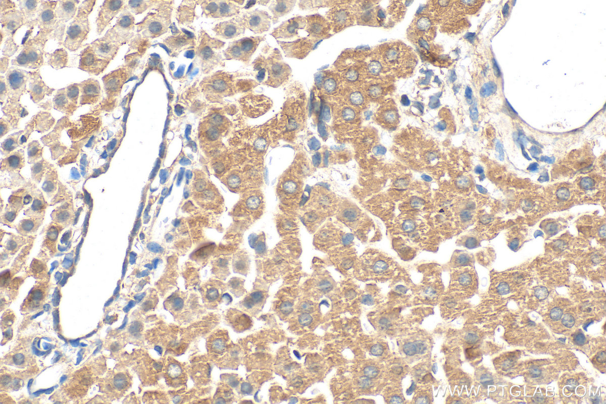 IHC staining of mouse liver using 24087-1-AP
