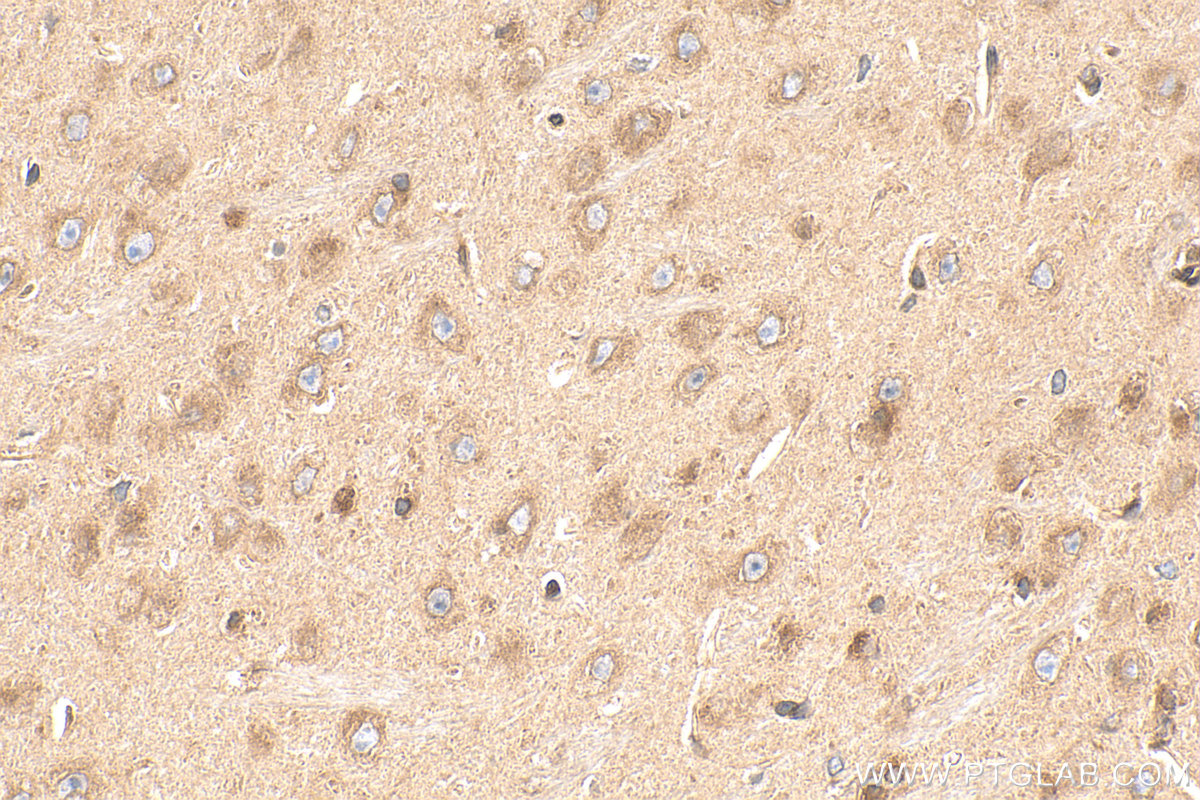 IHC staining of mouse brain using 24087-1-AP