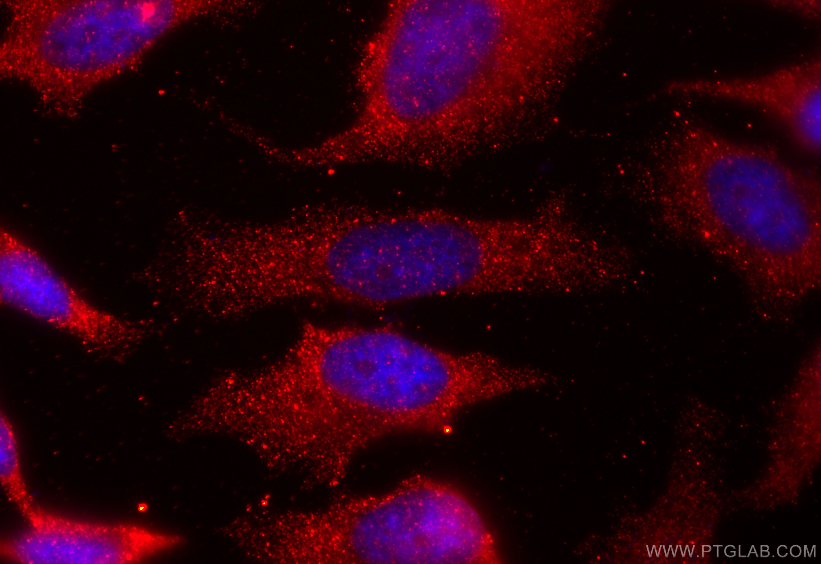 IF Staining of HeLa using 11821-1-AP