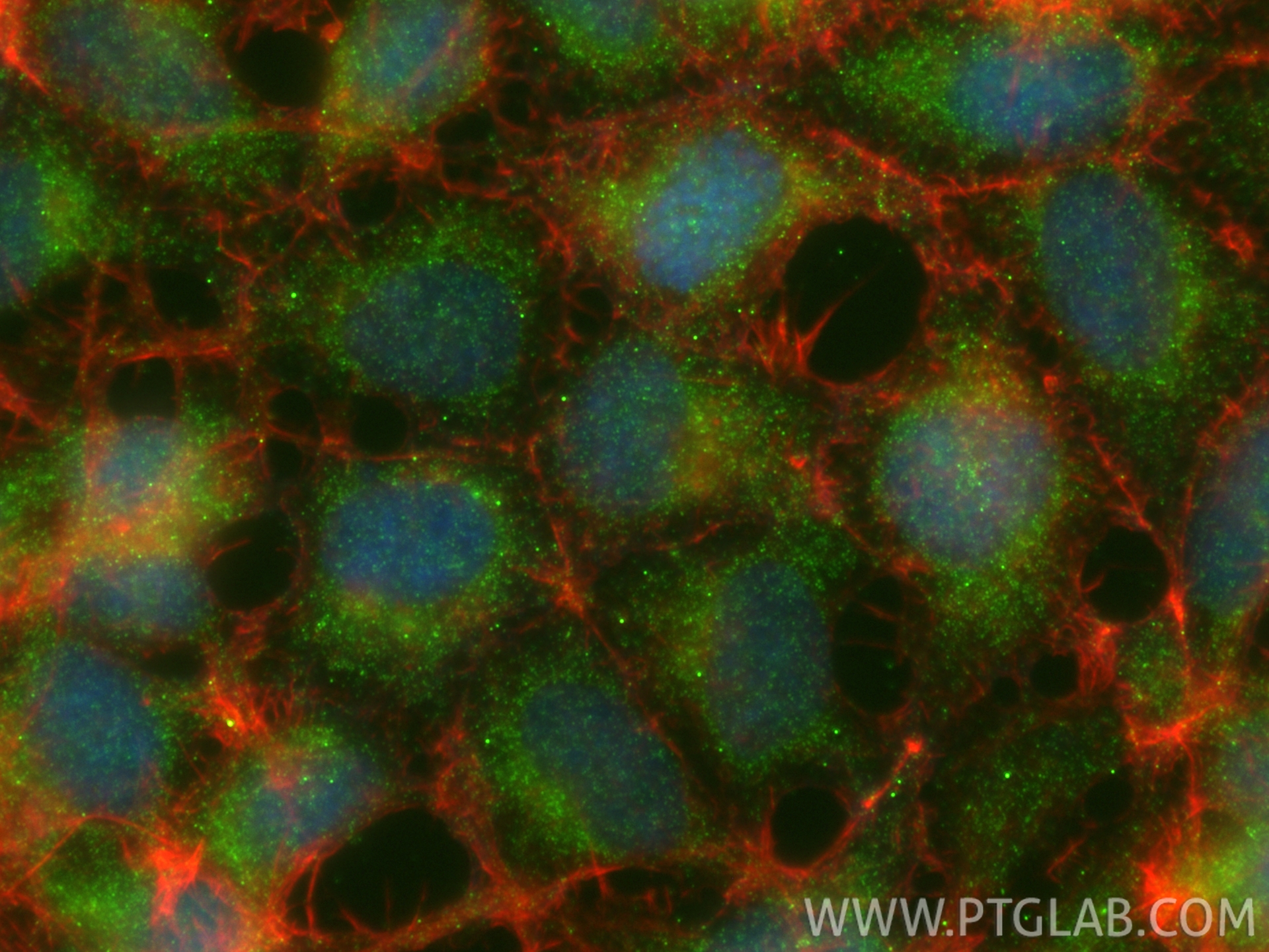 IF Staining of HEK-293 using 11821-1-AP IF Staining of HEK-293 using 11821-1-AP