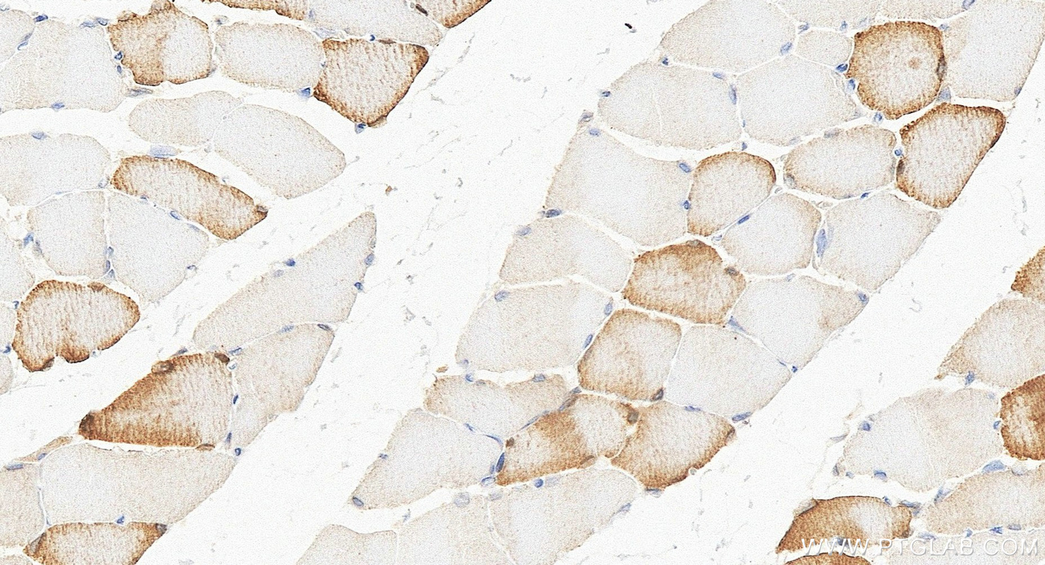 IHC staining of rat skeletal muscle using 11821-1-AP IHC staining of rat skeletal muscle using 11821-1-AP