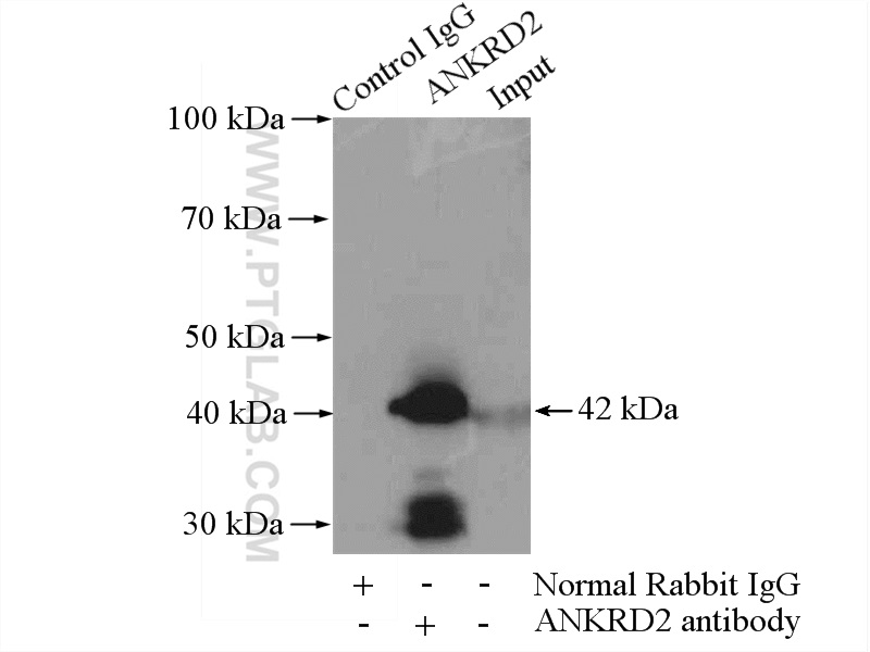 IP experiment of mouse skeletal muscle using 11821-1-AP