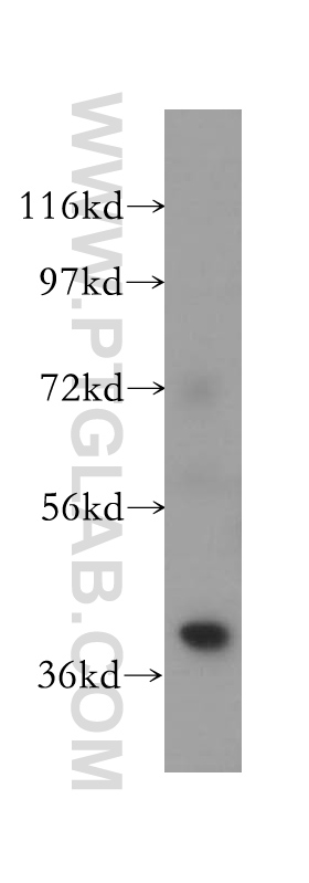 WB analysis of mouse skeletal muscle using 11821-1-AP