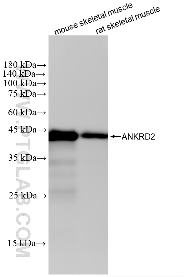 Various lysates were subjected to SDS PAGE followed by western blot with 87444-1-RR (ANKRD2 antibody) at dilution of 1:10000 incubated at room temperature for 1.5 hours. WB analysis using 87444-1-RR