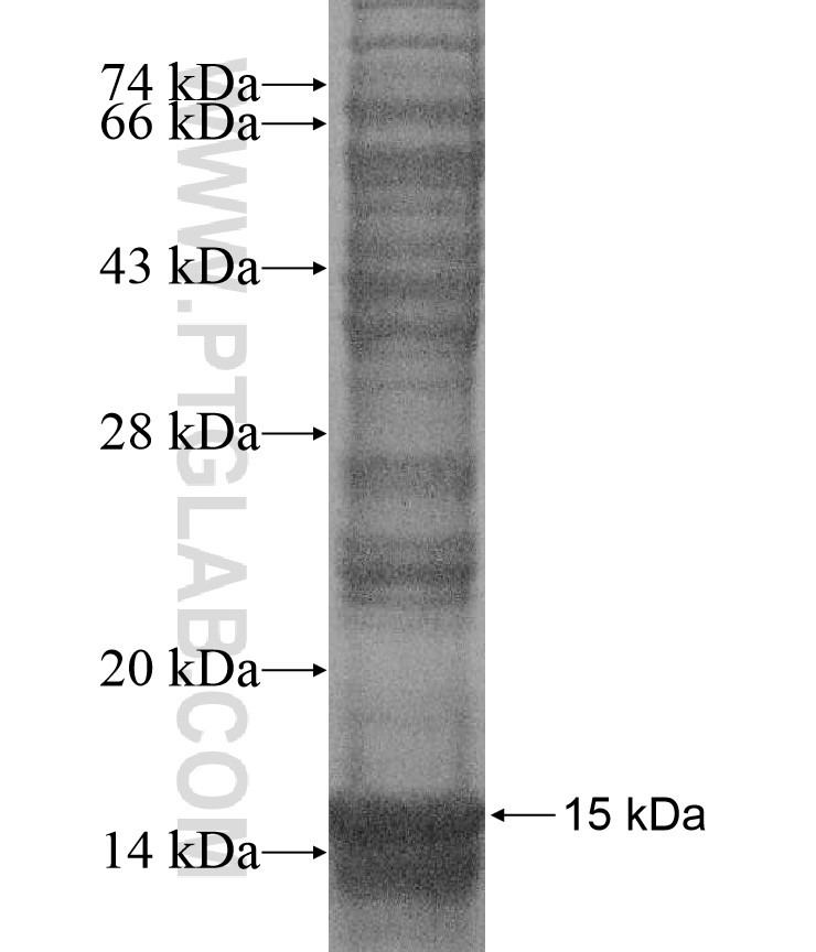 ANKRD20A5 fusion protein Ag16954 SDS-PAGE ANKRD20A5 fusion protein Ag16954 SDS-PAGE