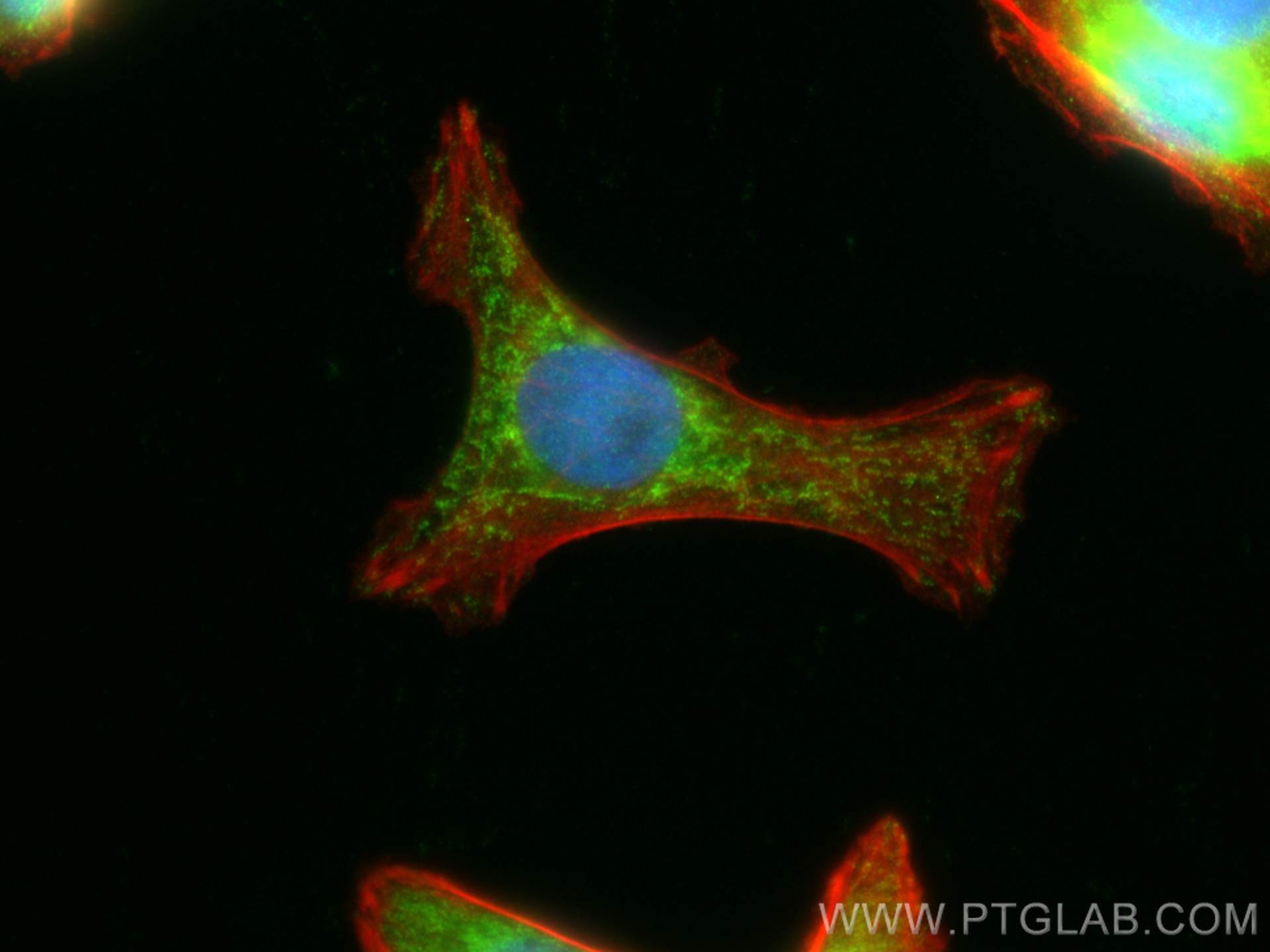 IF Staining of SW480 using 24035-1-AP