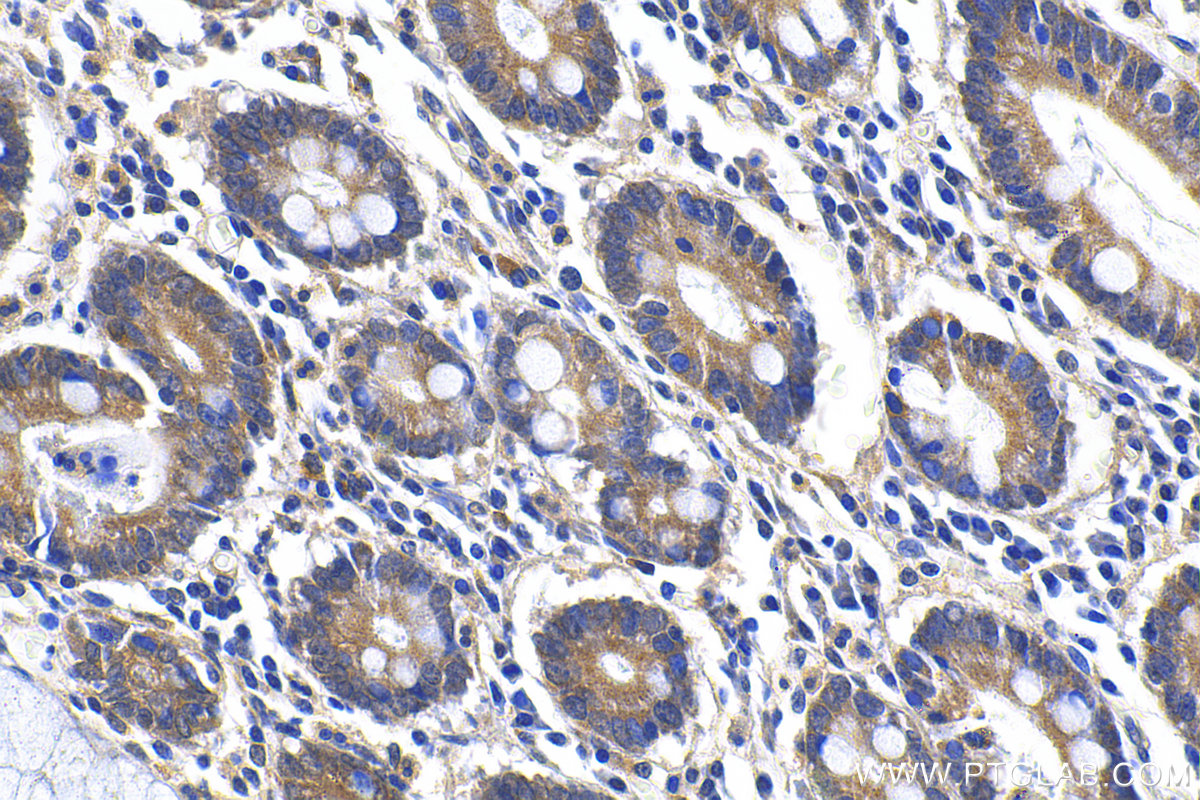 IHC staining of human stomach using 24035-1-AP