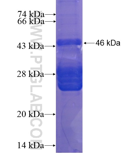 ANKRD23 fusion protein Ag15720 SDS-PAGE