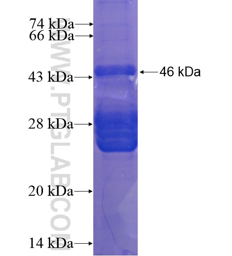 ANKRD23 fusion protein Ag15720 SDS-PAGE ANKRD23 fusion protein Ag15720 SDS-PAGE