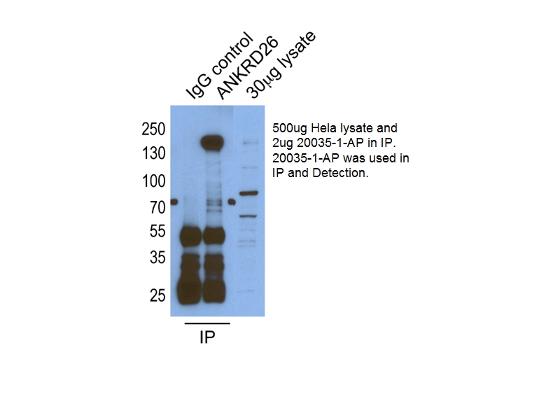 IP experiment of HeLa cells using 20035-1-AP