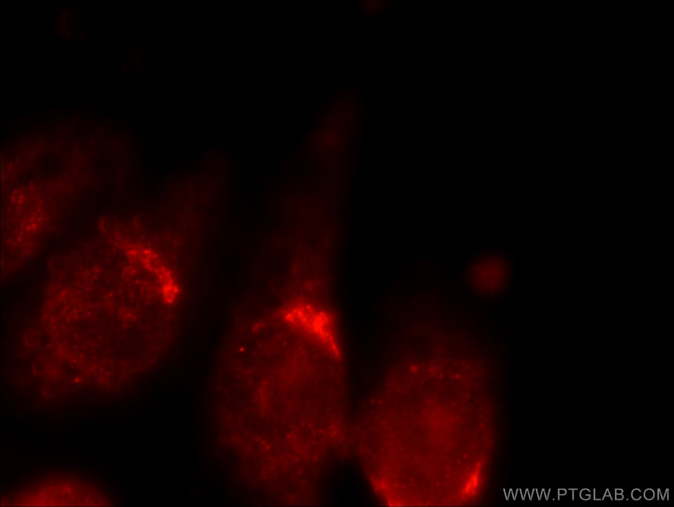 IF Staining of HeLa using 20035-1-AP