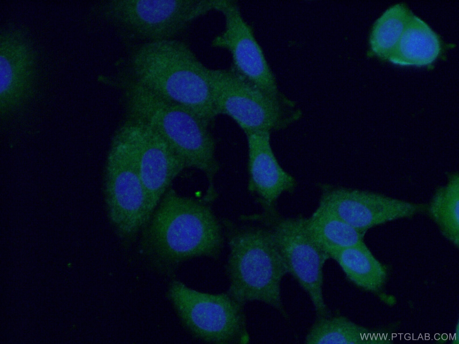 IF Staining of MCF-7 using 24034-1-AP